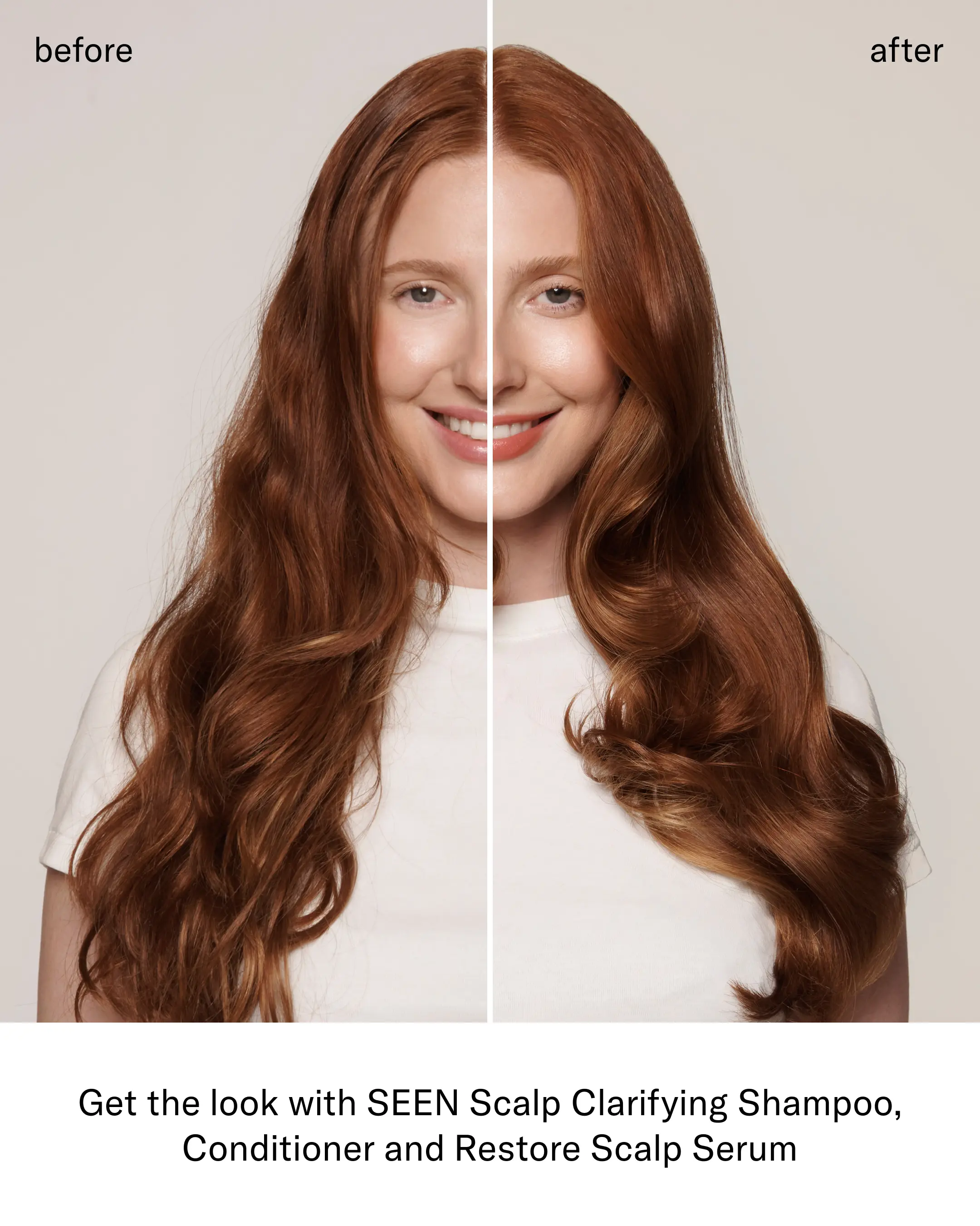 SEEN Healthy Scalp Bundle - Image 6